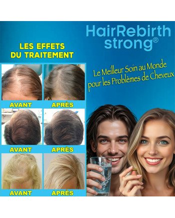 Hair Rebirth strong®: Arrête la Chute des Cheveux et les fait Renaître