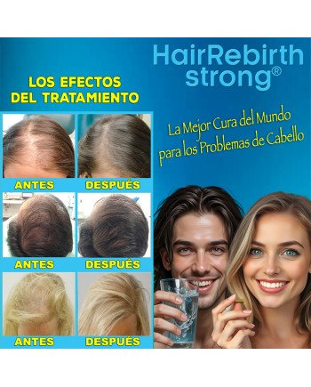 Hair Rebirth strong®: Detiene la Caída del Cabello y lo hace Renacer
