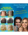 Hair Rebirth strong®: Detiene la Caída del Cabello y lo hace Renacer