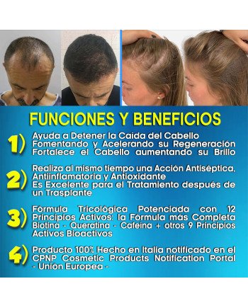 Hair Rebirth strong®: Detiene la Caída del Cabello y lo hace Renacer