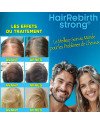 Hair Rebirth strong®: Arrête la Chute des Cheveux et les fait Renaître
