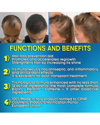 Hair Rebirth strong®: Stops the Hair Loss and Regrowth It