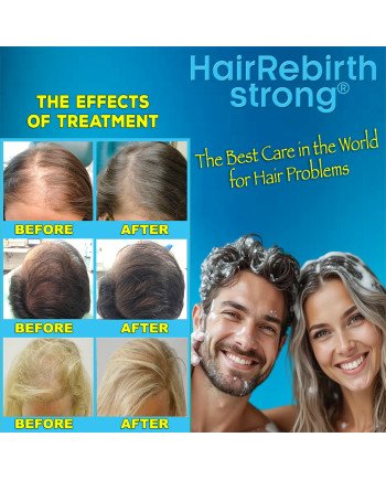 Hair Rebirth strong®: Stops the Hair Loss and Regrowth It