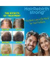 Hair Rebirth strong®: Stops the Hair Loss and Regrowth It