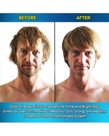 Hair Rebirth strong®: Stops the Hair Loss and Regrowth It