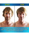 Hair Rebirth strong®: Stops the Hair Loss and Regrowth It