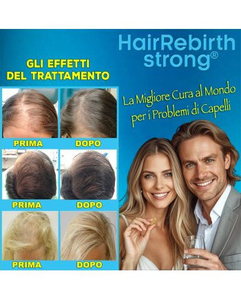 Hair Rebirth strong®: Arresta la Caduta dei Capelli e li fa Rinascere