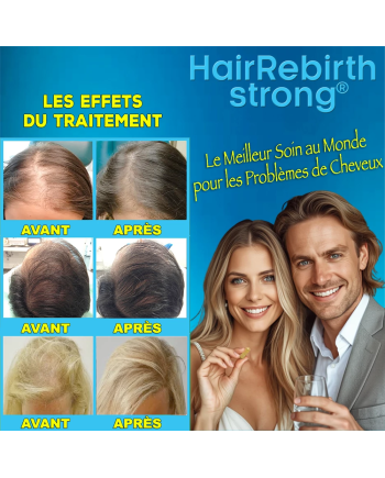 Hair Rebirth strong®: Arrête la Chute des Cheveux et les fait Renaître