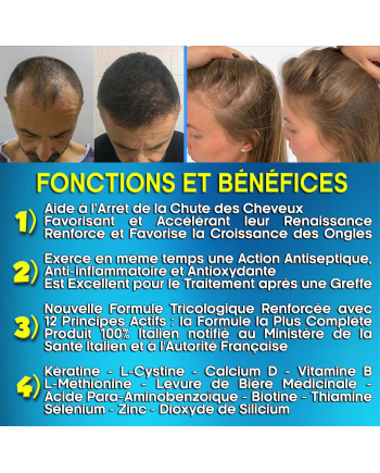 Hair Rebirth strong®: Arrête la Chute des Cheveux et les fait Renaître