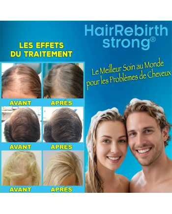 Hair Rebirth strong®: Arrête la Chute des Cheveux et les fait Renaître