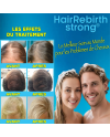 Hair Rebirth strong®: Arrête la Chute des Cheveux et les fait Renaître
