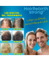 Hair Rebirth strong®: Detiene la Caída del Cabello y lo hace Renacer