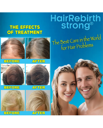 Hair Rebirth strong®: Stops the Hair Loss and Regrowth It