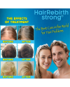 Hair Rebirth strong®: Stops the Hair Loss and Regrowth It