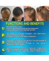 Hair Rebirth strong®: Stops the Hair Loss and Regrowth It
