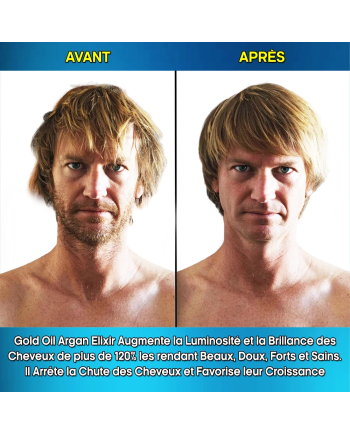 Hair Rebirth strong®: Arrête la Chute des Cheveux et les fait Renaître