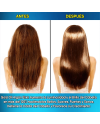 Hair Rebirth strong®: Detiene la Caída del Cabello y lo hace Renacer